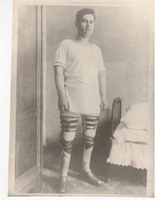 Aleksey Maresyev with prostethic legs